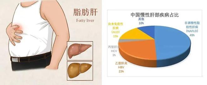 坐凳子坐三分之一减肥_减肥机构药垫减肥_