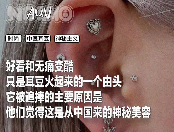 中医的耳穴埋豆，征服东京银座的高级美容院__中医的耳穴埋豆，征服东京银座的高级美容院