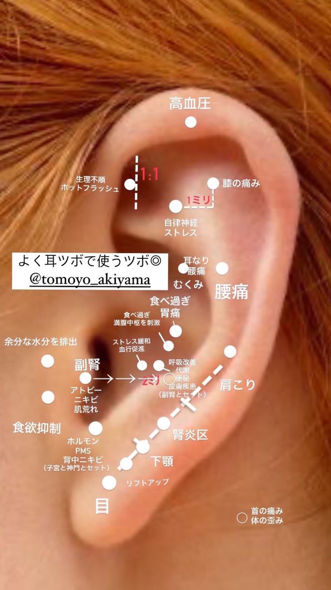 中医的耳穴埋豆，征服东京银座的高级美容院_中医的耳穴埋豆，征服东京银座的高级美容院_