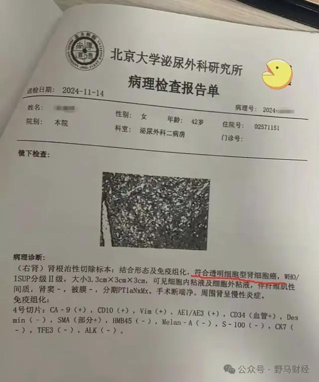 次责可以像主责要误工费吗__主责和次责保险是互赔