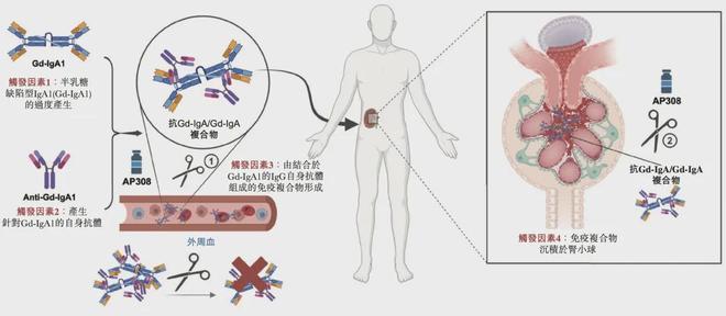 最大蓝海，肾脏病第一股亮相__最大蓝海，肾脏病第一股亮相