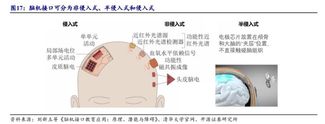 _埃隆马斯克脑机接口精神_集体土地证能填商业吗