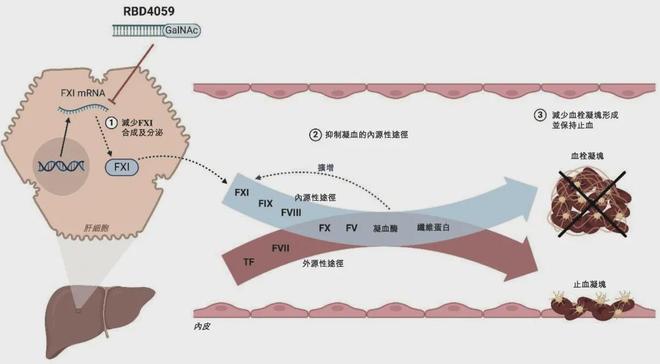 FXI小核酸药，王炸！