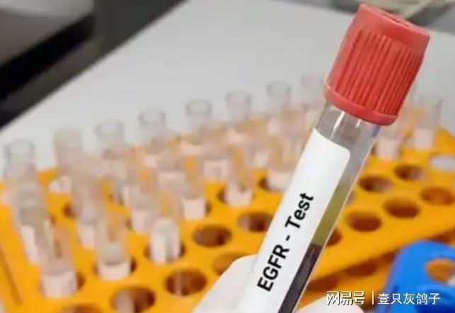 把没病说成有病，帮美国药企收割中国老百姓，高知姐弟迎来大清算__把没病说成有病，帮美国药企收割中国老百姓，高知姐弟迎来大清算